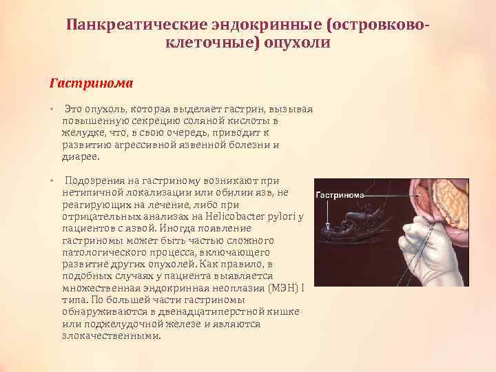 Панкреатические эндокринные (островковоклеточные) опухоли Гастринома • Это опухоль, которая выделяет гастрин, вызывая повышенную секрецию