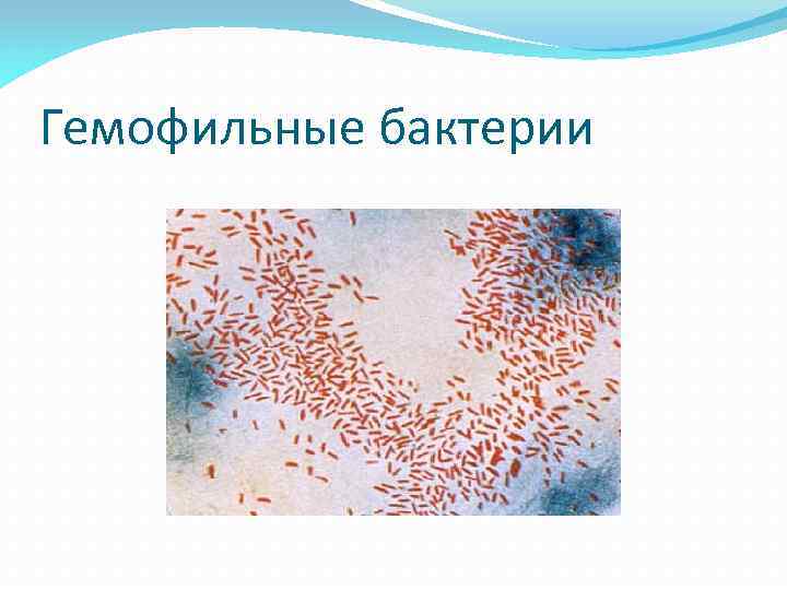 Гемофильные бактерии 