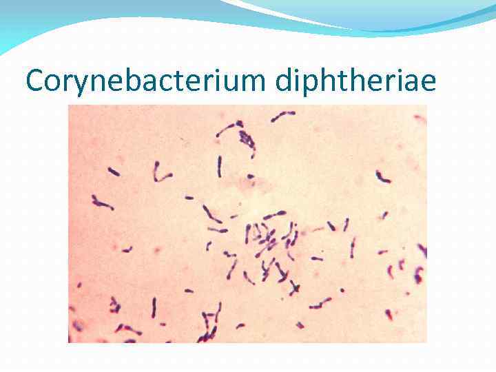 Сorynebacterium diphtheriae 