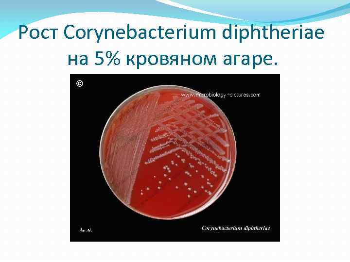 Рост Corynebacterium diphtheriae на 5% кровяном агаре. 