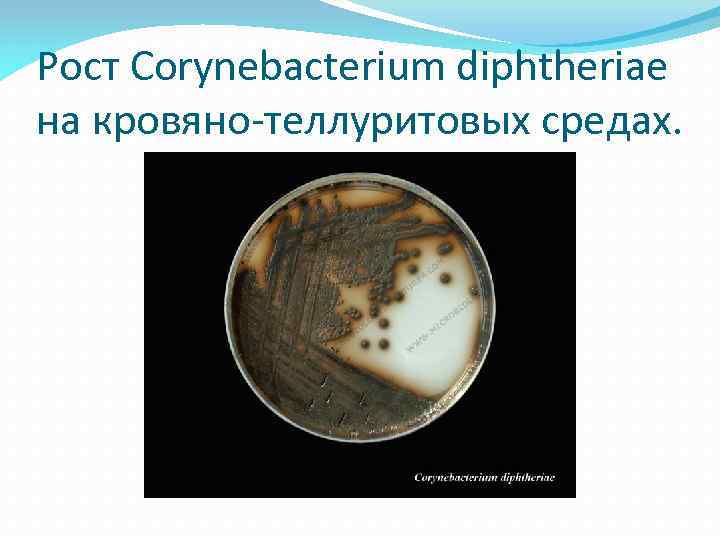 Рост Corynebacterium diphtheriae на кровяно-теллуритовых средах. 