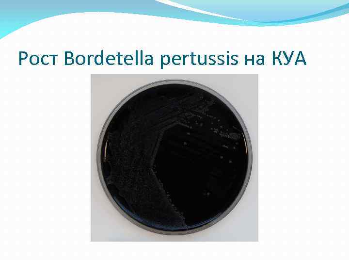 Рост Bordetella pertussis на КУА 