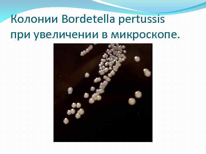 Колонии Bordetella pertussis при увеличении в микроскопе. 