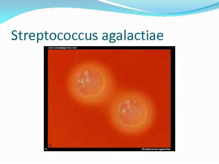 Streptococcus agalactiae 