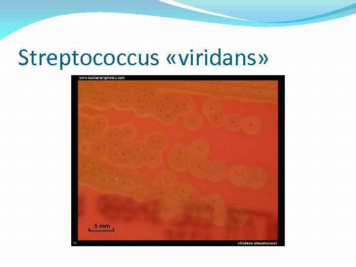 Streptococcus «viridans» 
