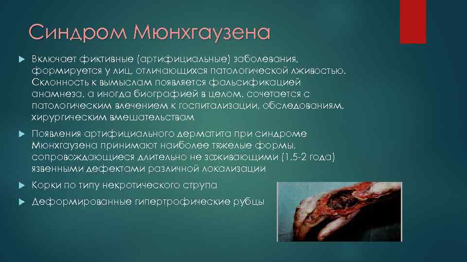 Синдром Мюнхгаузена Включает фиктивные (артифициальные) заболевания, формируется у лиц, отличающихся патологической лживостью. Склонность к