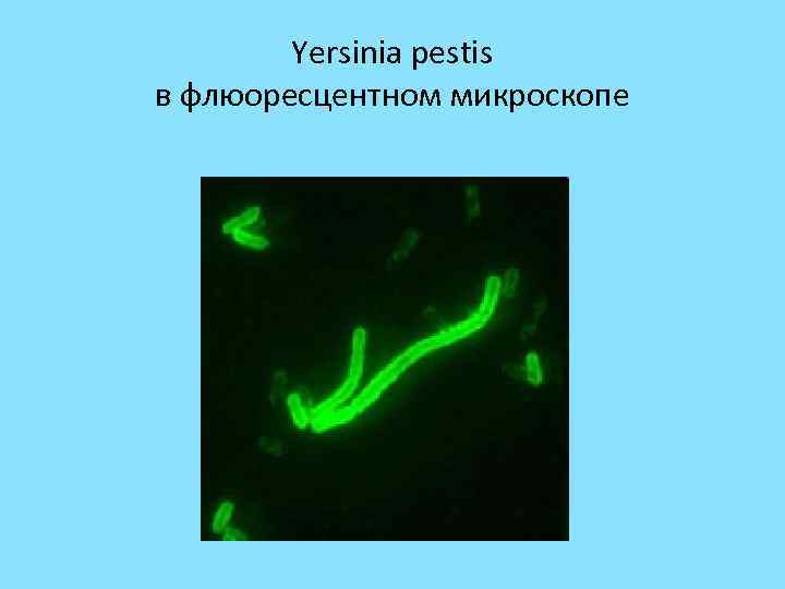 Yersinia pestis в флюоресцентном микроскопе 