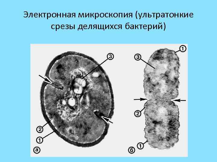 Микроскопия микробиология презентация