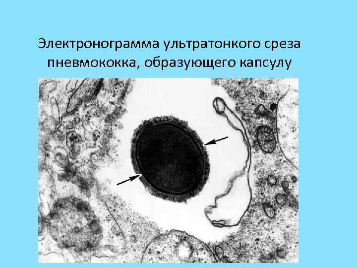 Электронограмма ультратонкого среза пневмококка, образующего капсулу 