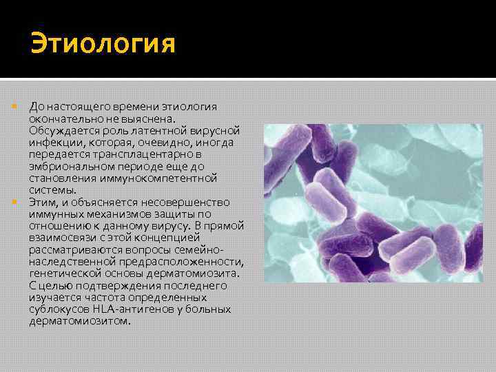 Этиология До настоящего времени этиология окончательно не выяснена. Обсуждается роль латентной вирусной инфекции, которая,