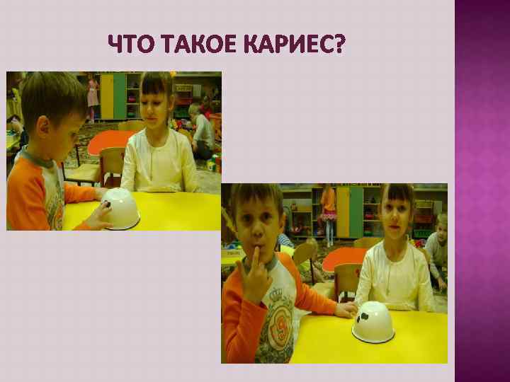 ЧТО ТАКОЕ КАРИЕС? 