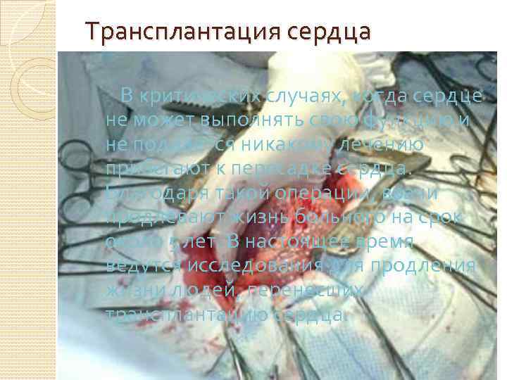 Трансплантация сердца В критических случаях, когда сердце не может выполнять свою функцию и не