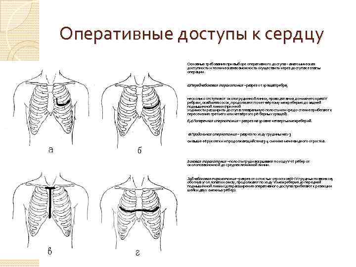 Оперативные доступы к сердцу Основные требования при выборе оперативного доступа – анатомическая доступность и