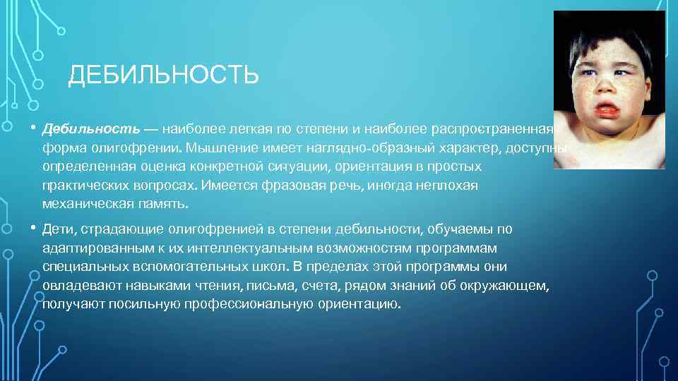 ДЕБИЛЬНОСТЬ • Дебильность — наиболее легкая по степени и наиболее распро траненная с форма