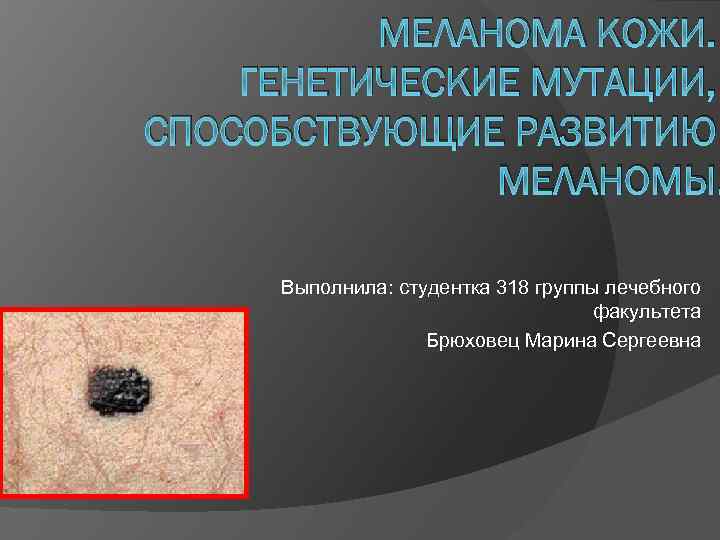МЕЛАНОМА КОЖИ. ГЕНЕТИЧЕСКИЕ МУТАЦИИ, СПОСОБСТВУЮЩИЕ РАЗВИТИЮ МЕЛАНОМЫ. Выполнила: студентка 318 группы лечебного факультета Брюховец