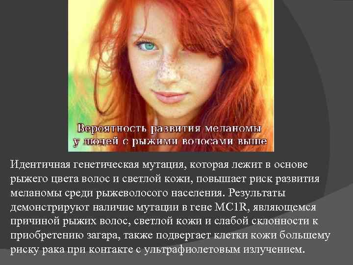 Идентичная генетическая мутация, которая лежит в основе рыжего цвета волос и светлой кожи, повышает