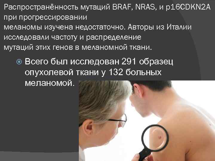 Распространённость мутаций BRAF, NRAS, и p 16 CDKN 2 A при прогрессировании меланомы изучена