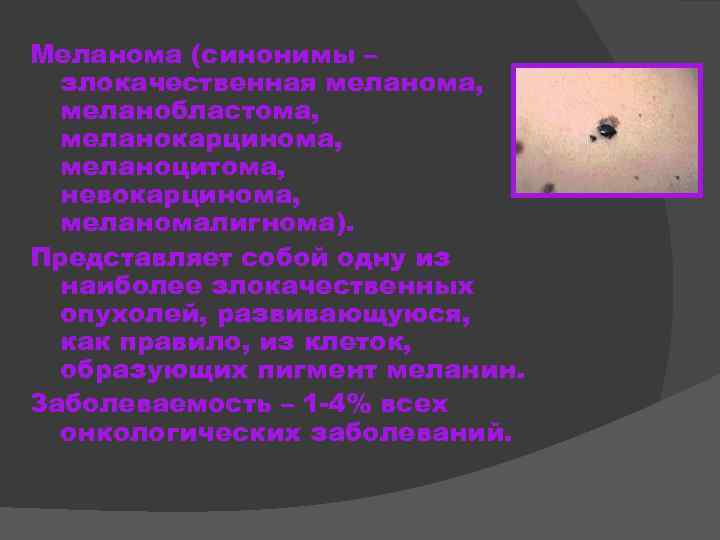 Меланома (синонимы – злокачественная меланома, меланобластома, меланокарцинома, меланоцитома, невокарцинома, меланомалигнома). Представляет собой одну из