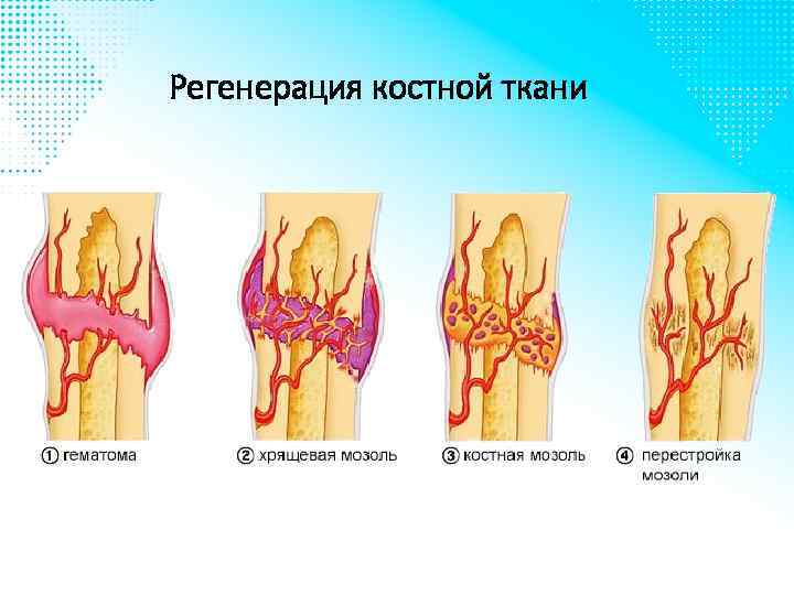 Регенерация костной ткани 