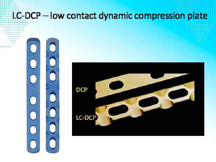 LC-DCP – low contact dynamic compression plate 