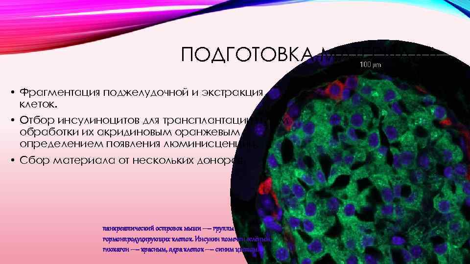 ПОДГОТОВКА МАТЕРИАЛА • Фрагментация поджелудочной и экстракция клеток. • Отбор инсулиноцитов для трансплантации путем