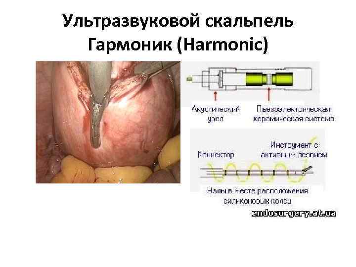 Ультразвуковой скальпель Гармоник (Harmonic) 