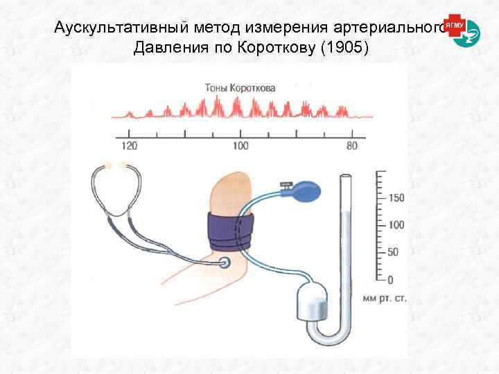 Аускультативный метод измерения артериального Давления по Короткову (1905) 