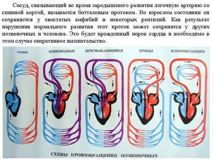 Сосуд, связывающий во время зародышевого развития легочную артерию со спинной аортой, называется ботталовым протоком.