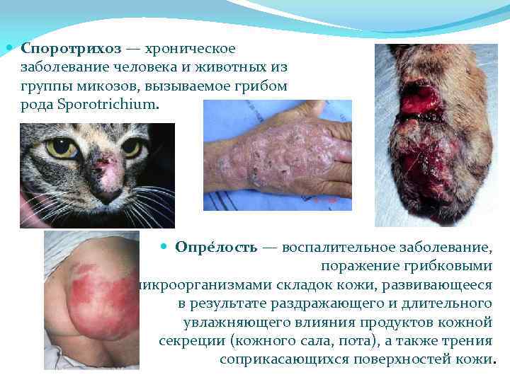  Споротрихоз — хроническое заболевание человека и животных из группы микозов, вызываемое грибом рода