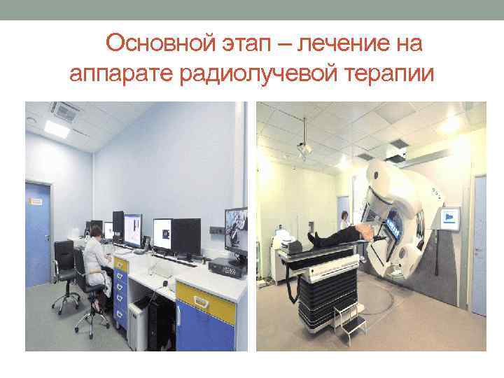 Основной этап – лечение на аппарате радиолучевой терапии 