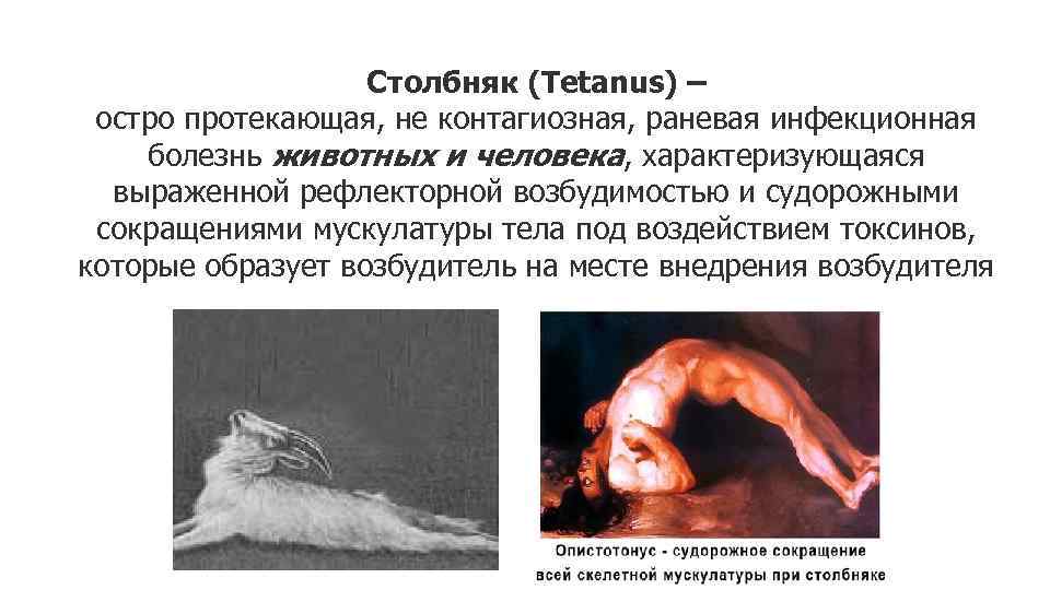 Столбняк (Tetanus) – остро протекающая, не контагиозная, раневая инфекционная болезнь животных и человека, характеризующаяся