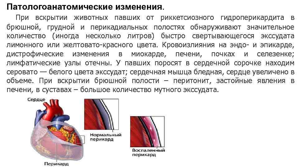 Перикард что это простыми словами. Возбудитель гидроперикардита. Риккетсиозный гидроперикардит животных. Инфекционный гидроперикардит.