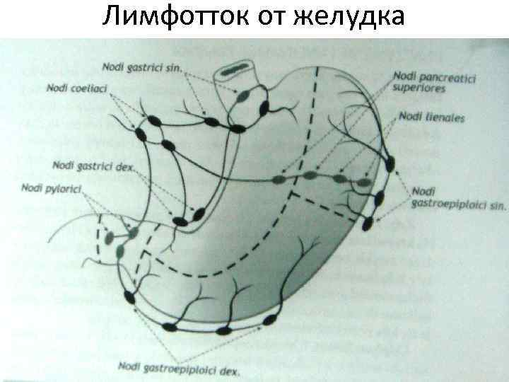 Лимфотток от желудка 