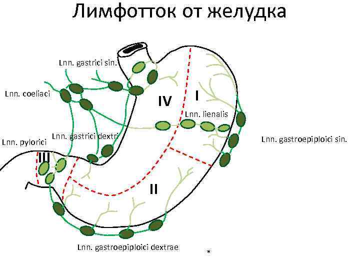 Лимфотток от желудка Lnn. gastrici sin. Lnn. coeliaci Lnn. pylorici IV I Lnn. lienalis