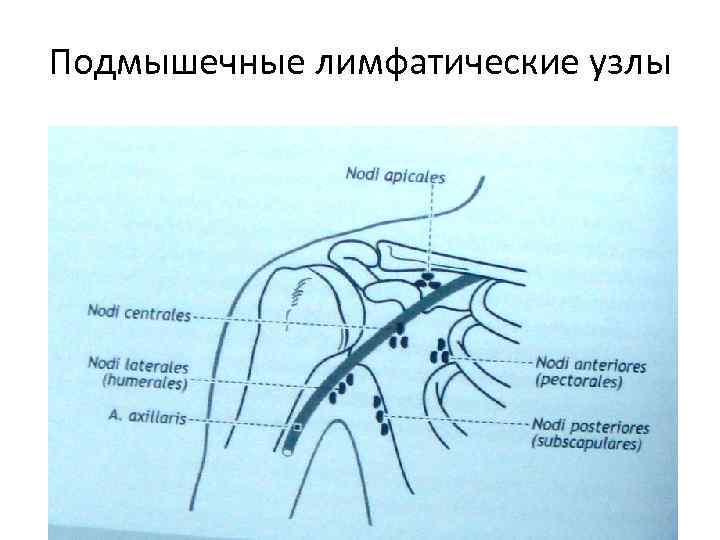 Подмышечные лимфатические узлы расположение у женщин фото