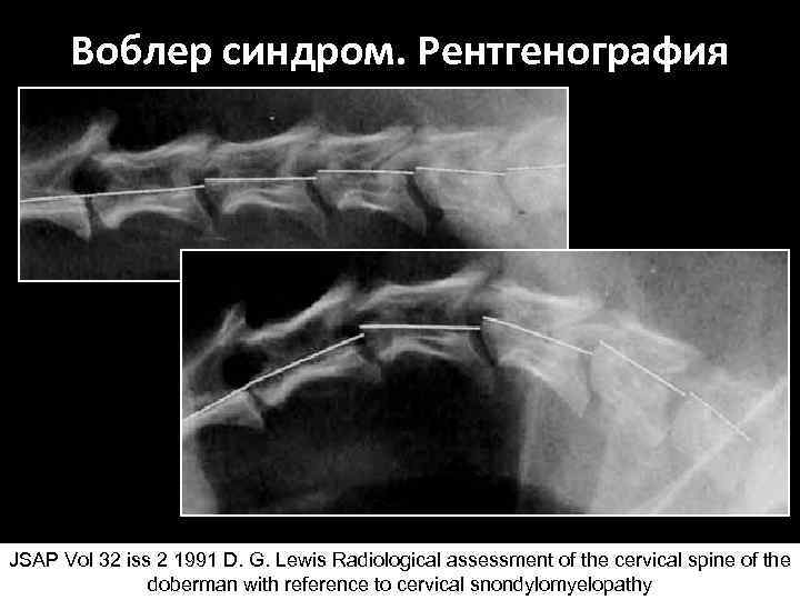 Воблер синдром. Рентгенография JSAP Vol 32 iss 2 1991 D. G. Lewis Radiological assessment