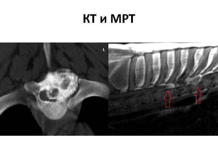 КТ и МРТ 