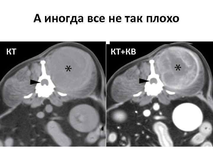 Кт в неврологии презентация