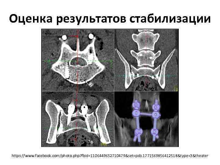 Кт в неврологии презентация