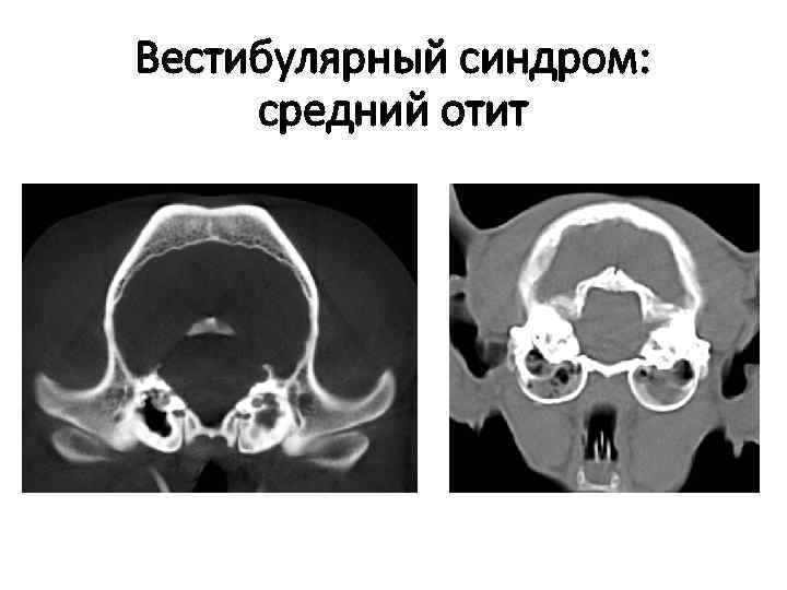 Кт в неврологии презентация