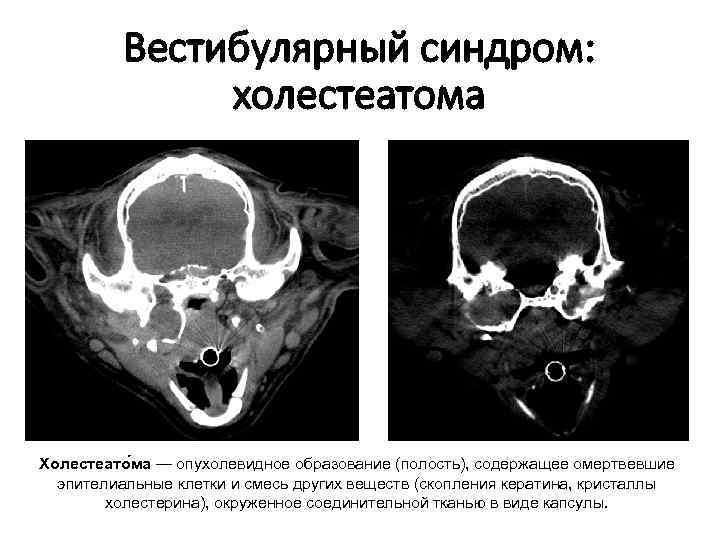 Кт в неврологии презентация