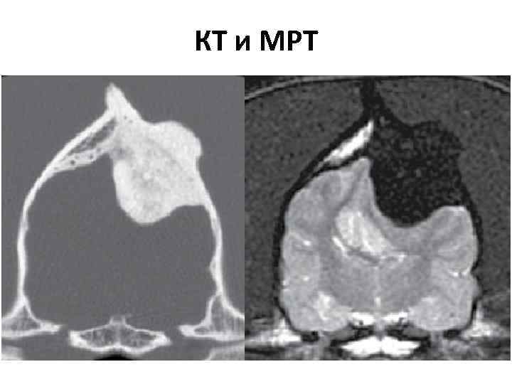 КТ и МРТ 
