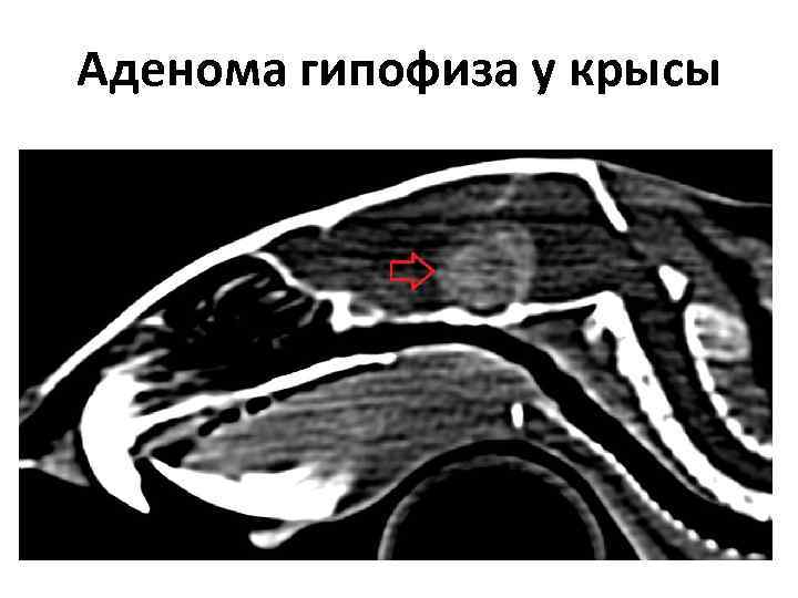 Кт в неврологии презентация