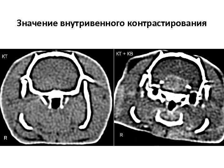 Значение внутривенного контрастирования 