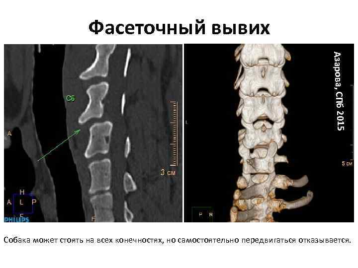 Фасеточный вывих Азарова, СПб 2015 Собака может стоять на всех конечностях, но самостоятельно передвигаться