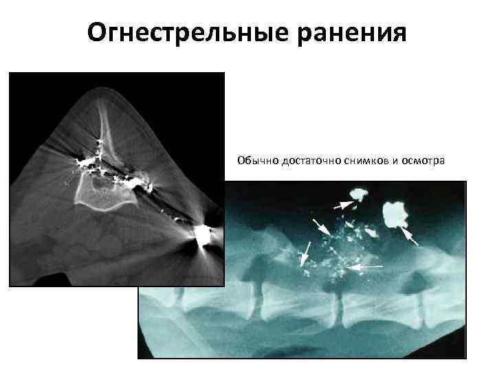 Огнестрельные ранения Обычно достаточно снимков и осмотра 