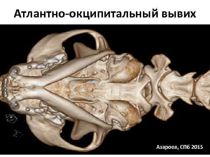 Кт в неврологии презентация