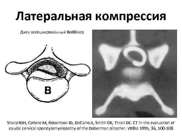 Латеральная компрессия Диск ассоциированный Вобблер Sharp NJH, Cofone M, Robertson ID, De. Carlo A,