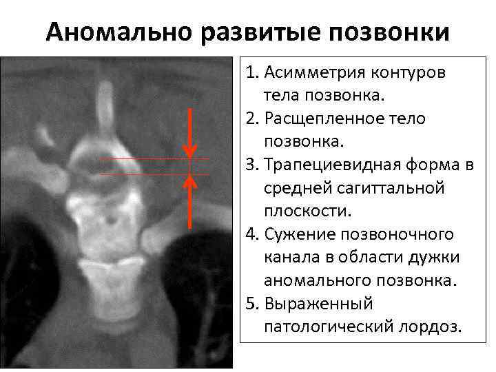 Кт в неврологии презентация