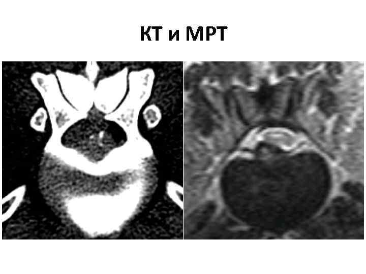 КТ и МРТ 